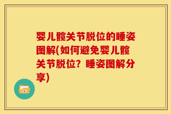 婴儿髋关节脱位的睡姿图解(如何避免婴儿髋关节脱位？睡姿图解分享)