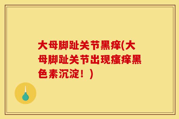 大母脚趾关节黑痒(大母脚趾关节出现瘙痒黑色素沉淀！)