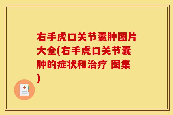 右手虎口关节囊肿图片大全(右手虎口关节囊肿的症状和治疗 图集)