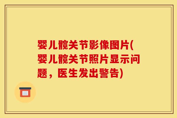 婴儿髋关节影像图片(婴儿髋关节照片显示问题，医生发出警告)