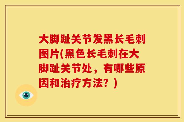 大脚趾关节发黑长毛刺图片(黑色长毛刺在大脚趾关节处，有哪些原因和治疗方法？)