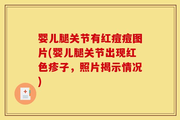 婴儿腿关节有红痘痘图片(婴儿腿关节出现红色疹子，照片揭示情况)