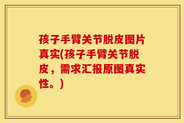 孩子手臂关节脱皮图片真实(孩子手臂关节脱皮，需求汇报原图真实性。)