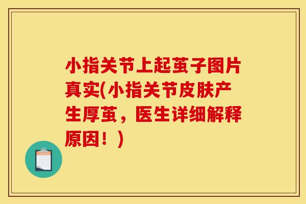 小指关节上起茧子图片真实(小指关节皮肤产生厚茧，医生详细解释原因！)