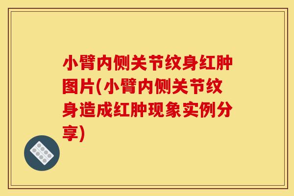 小臂内侧关节纹身红肿图片(小臂内侧关节纹身造成红肿现象实例分享)