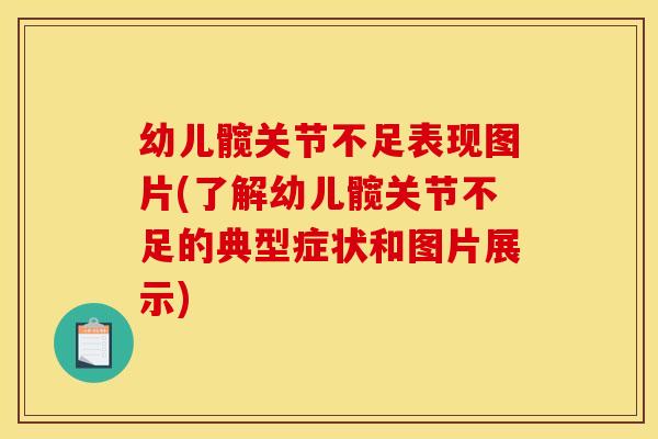 幼儿髋关节不足表现图片(了解幼儿髋关节不足的典型症状和图片展示)-第1张图片-关节骑士 幼儿髋关节不足表现图片(了解幼儿髋关节不足的典型症状和图片展示)-第1张图片-关节骑士