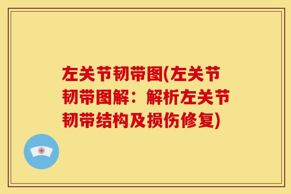 左关节韧带图(左关节韧带图解：解析左关节韧带结构及损伤修复)
