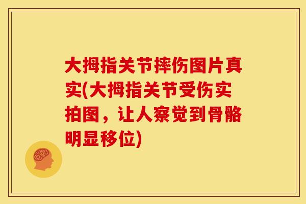 大拇指关节摔伤图片真实(大拇指关节受伤实拍图，让人察觉到骨骼明显移位)