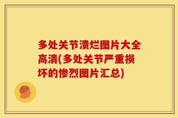 多处关节溃烂图片大全高清(多处关节严重损坏的惨烈图片汇总)