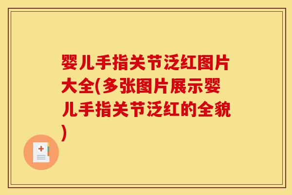 婴儿手指关节泛红图片大全(多张图片展示婴儿手指关节泛红的全貌)-第1张图片-关节骑士