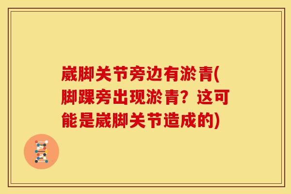 崴脚关节旁边有淤青(脚踝旁出现淤青？这可能是崴脚关节造成的)