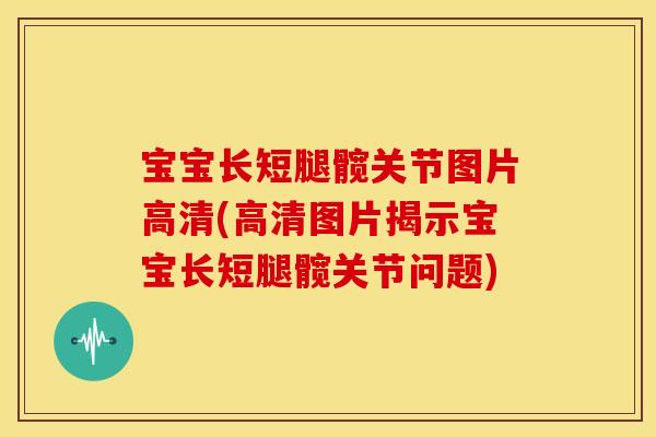 宝宝长短腿髋关节图片高清(高清图片揭示宝宝长短腿髋关节问题)