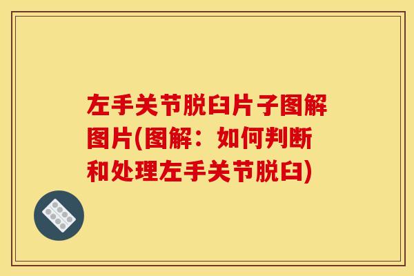 左手关节脱臼片子图解图片(图解：如何判断和处理左手关节脱臼)