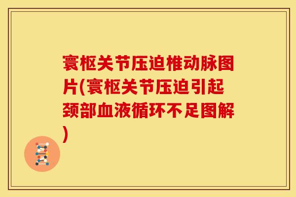 寰枢关节压迫椎动脉图片(寰枢关节压迫引起颈部血液循环不足图解)