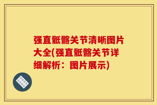 强直骶髂关节清晰图片大全(强直骶髂关节详细解析:图片展示)-第1张图片-关节骑士 强直骶髂关节清晰图片大全(强直骶髂关节详细解析:图片展示)-第1张图片-关节骑士