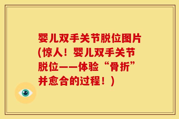 婴儿双手关节脱位图片(惊人！婴儿双手关节脱位——体验“骨折”并愈合的过程！)