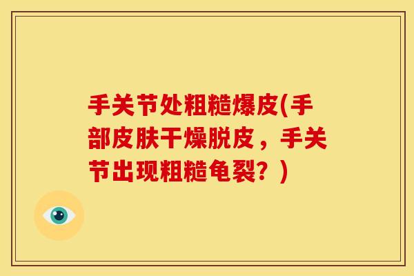 手关节处粗糙爆皮(手部皮肤干燥脱皮,手关节出现粗糙龟裂?)-第1张图片-关节骑士 手关节处粗糙爆皮(手部皮肤干燥脱皮,手关节出现粗糙龟裂?)-第1张图片-关节骑士