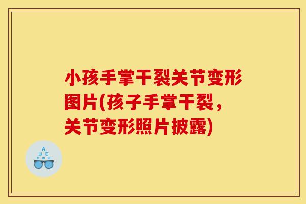 小孩手掌干裂关节变形图片(孩子手掌干裂，关节变形照片披露)