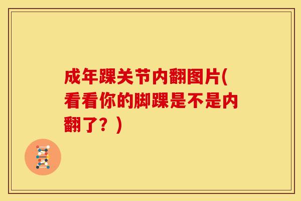 成年踝关节内翻图片(看看你的脚踝是不是内翻了？)