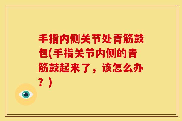 手指内侧关节处青筋鼓包(手指关节内侧的青筋鼓起来了,该怎么办?)-第1张图片-关节骑士 手指内侧关节处青筋鼓包(手指关节内侧的青筋鼓起来了,该怎么办?)-第1张图片-关节骑士
