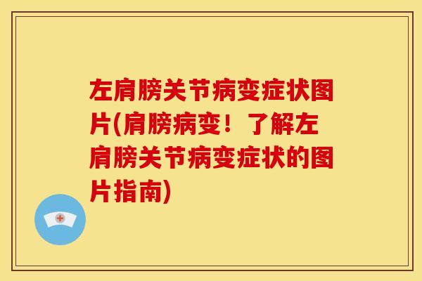 左肩膀关节病变症状图片(肩膀病变！了解左肩膀关节病变症状的图片指南)