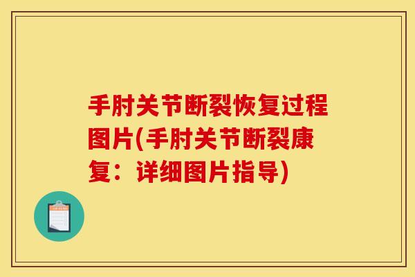 手肘关节断裂恢复过程图片(手肘关节断裂康复：详细图片指导)