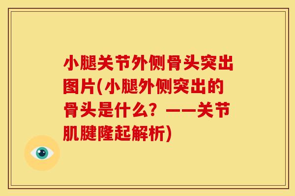 小腿关节外侧骨头突出图片(小腿外侧突出的骨头是什么？——关节肌腱隆起解析)