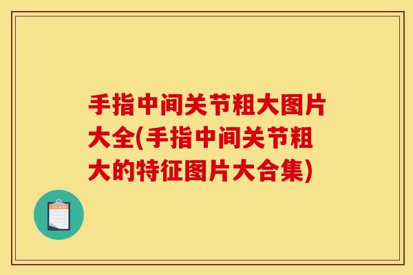 手指中间关节粗大图片大全(手指中间关节粗大的特征图片大合集)-第1张图片-关节骑士 手指中间关节粗大图片大全(手指中间关节粗大的特征图片大合集)-第1张图片-关节骑士