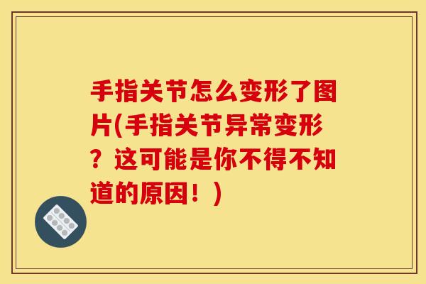 手指关节怎么变形了图片(手指关节异常变形？这可能是你不得不知道的原因！)