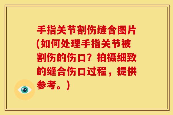 手指关节割伤缝合图片(如何处理手指关节被割伤的伤口？拍摄细致的缝合伤口过程，提供参考。)
