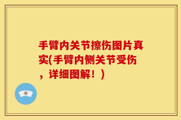手臂内关节擦伤图片真实(手臂内侧关节受伤，详细图解！)