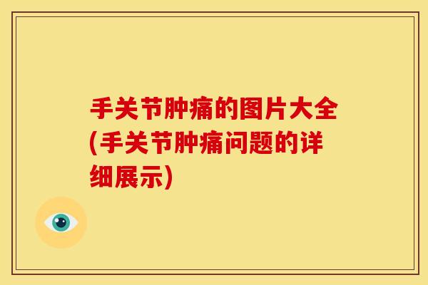 手关节肿痛的图片大全(手关节肿痛问题的详细展示)