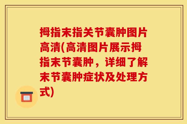 拇指末指关节囊肿图片高清(高清图片展示拇指末节囊肿，详细了解末节囊肿症状及处理方式)