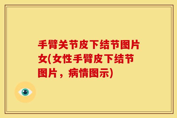 手臂关节皮下结节图片女(女性手臂皮下结节图片，病情图示)