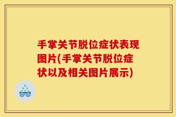 手掌关节脱位症状表现图片(手掌关节脱位症状以及相关图片展示)