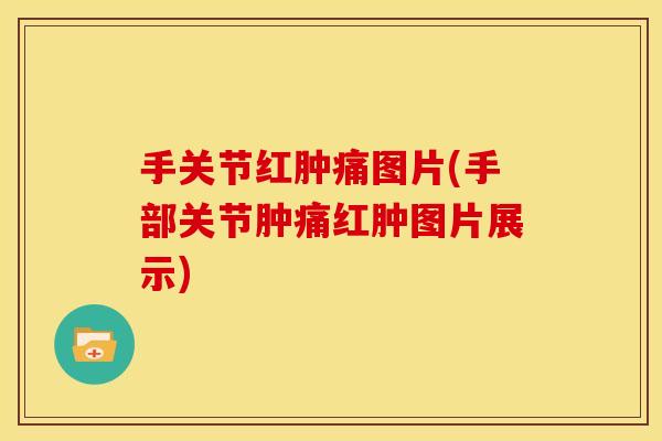 手关节红肿痛图片(手部关节肿痛红肿图片展示)