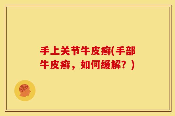 手上关节牛皮癣(手部牛皮癣，如何缓解？)
