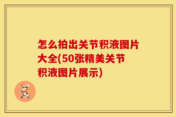 怎么拍出关节积液图片大全(50张精美关节积液图片展示)