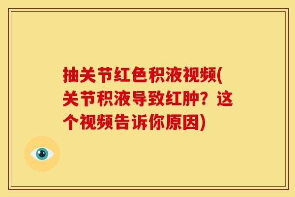 抽关节红色积液视频(关节积液导致红肿?这个视频告诉你原因)-第1张图片-关节骑士 抽关节红色积液视频(关节积液导致红肿?这个视频告诉你原因)-第1张图片-关节骑士