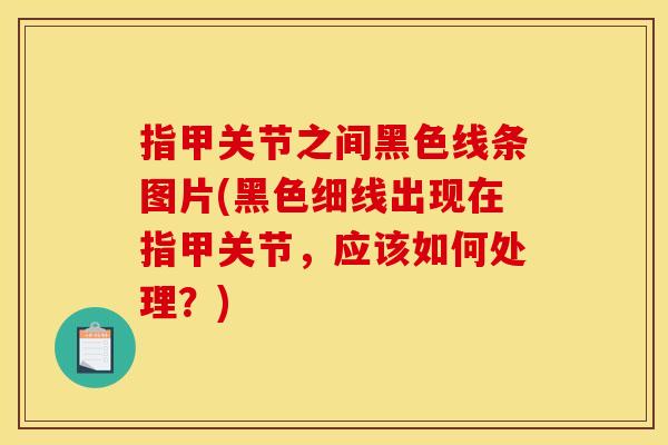 指甲关节之间黑色线条图片(黑色细线出现在指甲关节，应该如何处理？)
