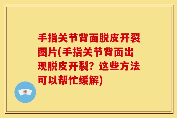 手指关节背面脱皮开裂图片(手指关节背面出现脱皮开裂？这些方法可以帮忙缓解)