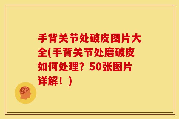 手背关节处破皮图片大全(手背关节处磨破皮如何处理？50张图片详解！)