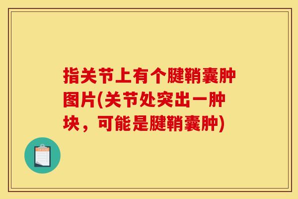 指关节上有个腱鞘囊肿图片(关节处突出一肿块，可能是腱鞘囊肿)