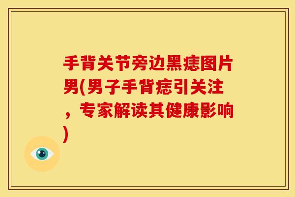 手背关节旁边黑痣图片男(男子手背痣引关注，专家解读其健康影响)