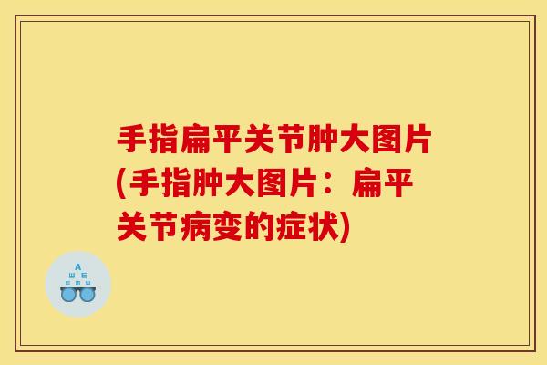 手指扁平关节肿大图片(手指肿大图片：扁平关节病变的症状)