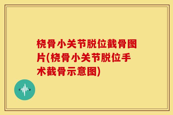 桡骨小关节脱位截骨图片(桡骨小关节脱位手术截骨示意图)