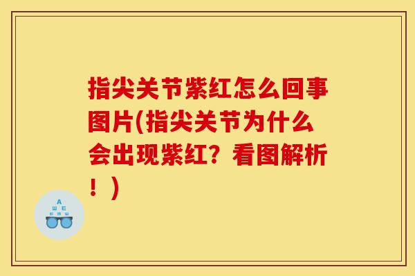 指尖关节紫红怎么回事图片(指尖关节为什么会出现紫红？看图解析！)