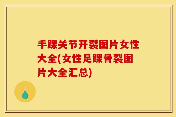 手踝关节开裂图片女性大全(女性足踝骨裂图片大全汇总)