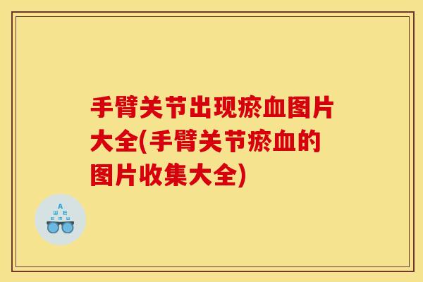 手臂关节出现瘀血图片大全(手臂关节瘀血的图片收集大全)
