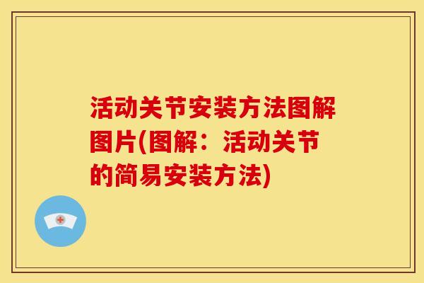 活动关节安装方法图解图片(图解：活动关节的简易安装方法)